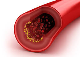 zagruzhennoe 5 Как понизить холестерин: народная медицина